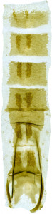 33 - 3858 Coleophora pustulosa abd.